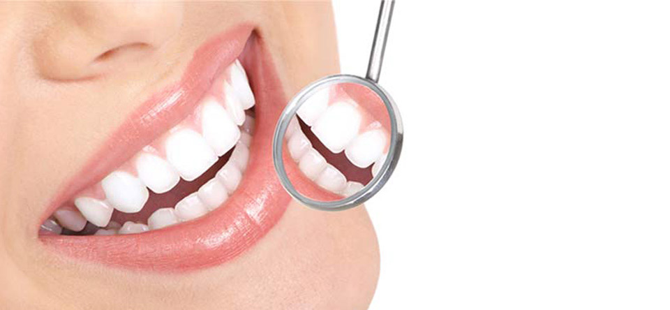 Cosmetic Tooth Filling
